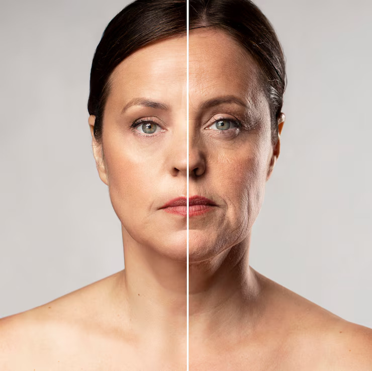 Rejuvenate Your Look with Natural-Looking Dermal Fillers