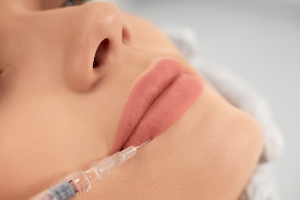 Enhance Your Smile with Beautiful, Natural-Looking Lip Fillers